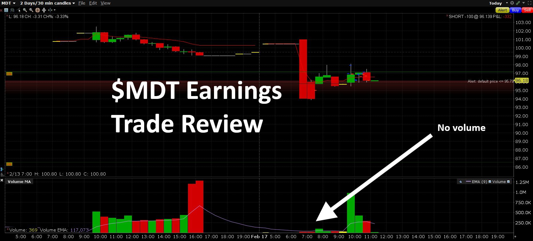 $MDT Earnings Trade Review: A Weak Setup, Over-Sized Position, and a Hard Lesson